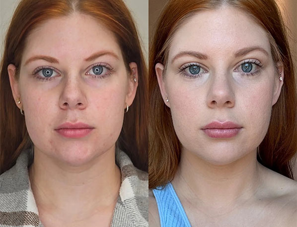 Before and After 2