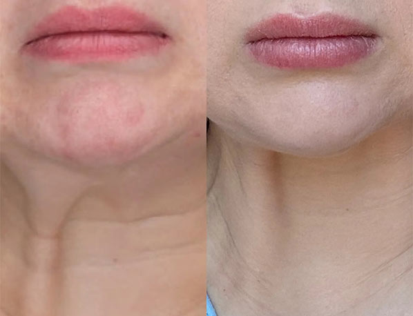 Before and After 3